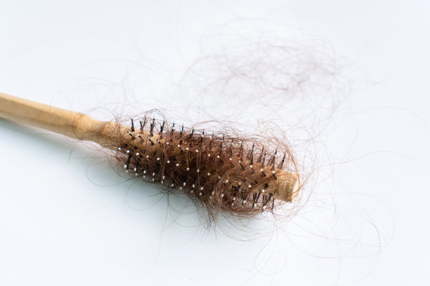 特写的梳子上掉了毛，头发掉了每天严重的问题。孤立在白色背景。图片下载