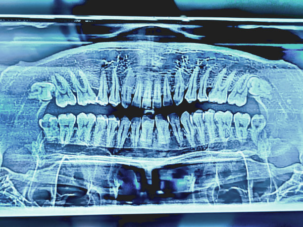 x射线牙压紧图片下载