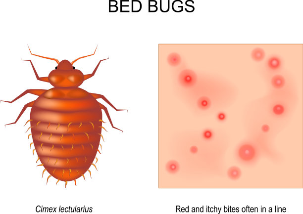 臭虫的皮肤与红色和痒咬特写图片下载