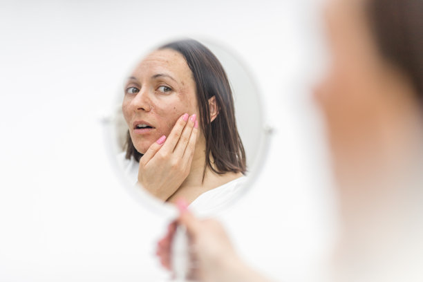 皮肤有问题的女人照镜子的照片。图片下载