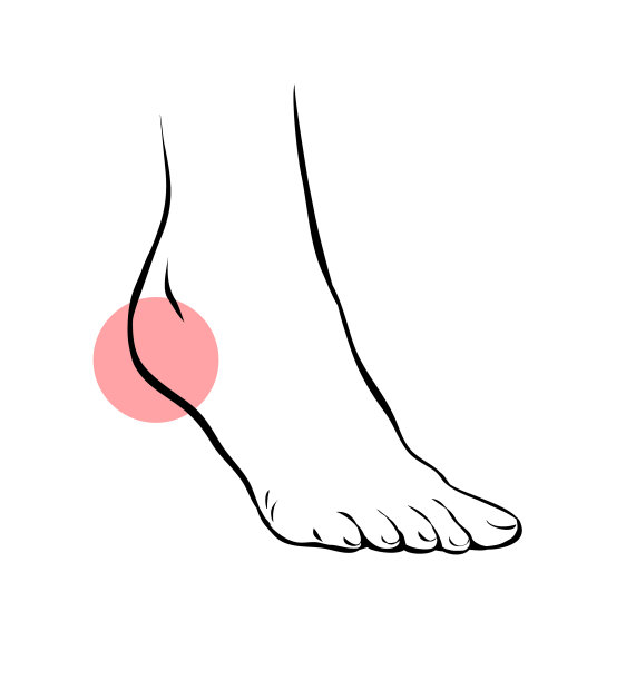 画出女性腿有问题的疼痛图片下载