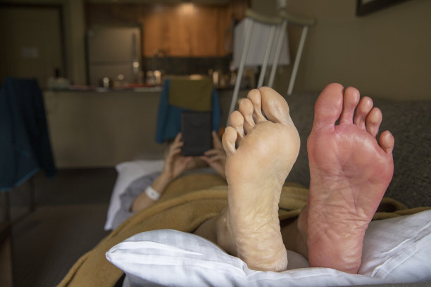 查看过去的脚康复病人在家里图片下载
