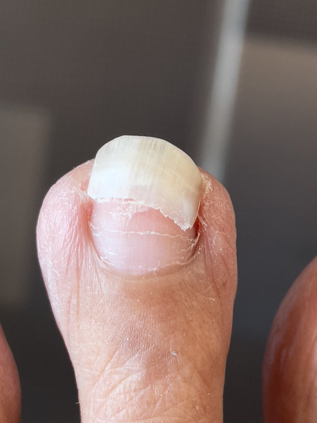 的脚趾甲图片下载