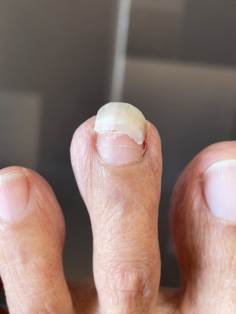 的脚趾甲图片下载