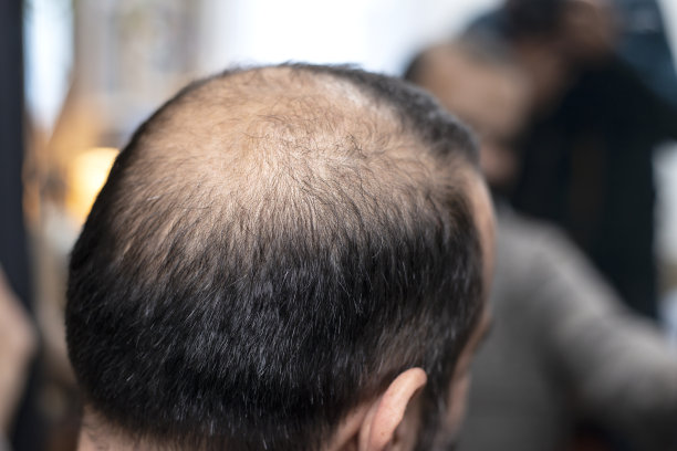 男人在镜子前检查头发图片下载