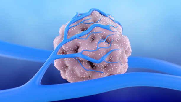 肿瘤细胞对血管生成的刺激图片下载