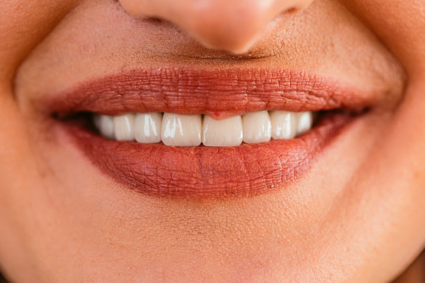 微笑的年轻白人妇女完美的白，甚至牙齿图片下载