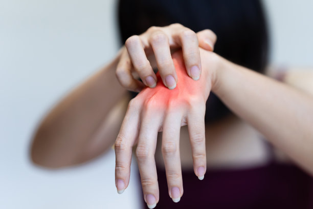 女人手发痒，是慢性皮肤病的征兆或其他疾病的症状。图片下载