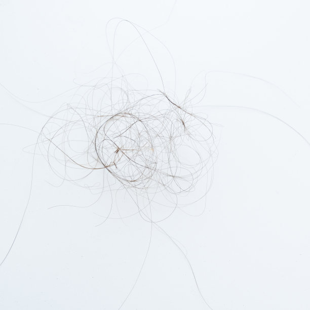 落在白底的头发。脱发问题图片下载