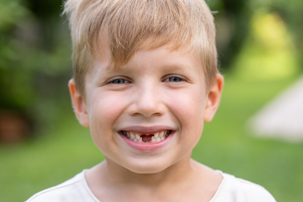 微笑的学龄缺牙男孩的肖像，缺了四颗门牙图片下载