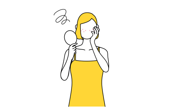 美容，女性形象护肤，患痤疮的女性肌肤图片下载