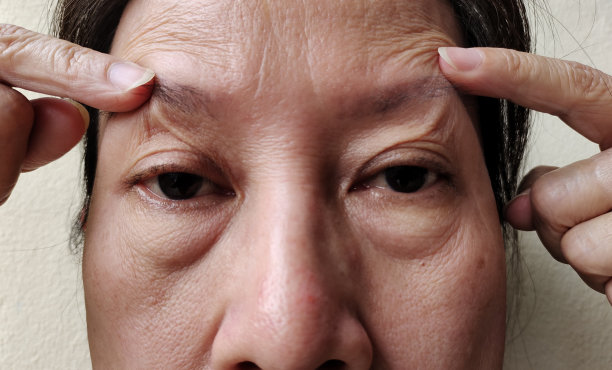 女人脸上松弛、皱纹、松弛的皮肤图片下载