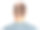 男子脱发问题治疗前后的白底，拼贴。来访的毛发学者图片下载