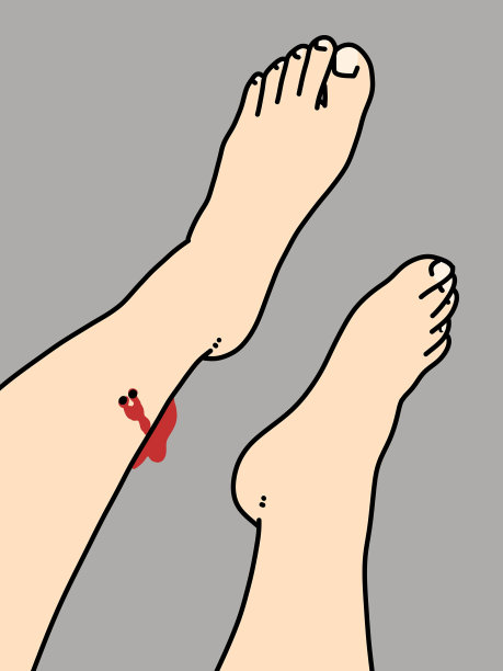 被蛇咬后的腿部动画图片下载