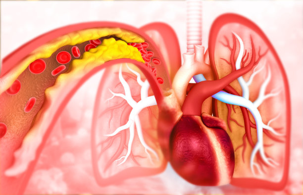 人类心脏动脉阻塞图片下载