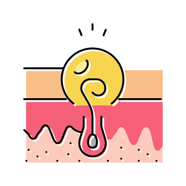 感染从内生发色图标矢量插图图片下载