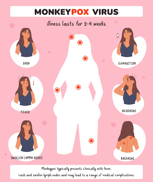 医学传单猴痘病毒症状。有猴痘病毒症状的资讯海报。病毒症状模板。发烧、头痛、皮疹。医疗保健和医疗图片下载