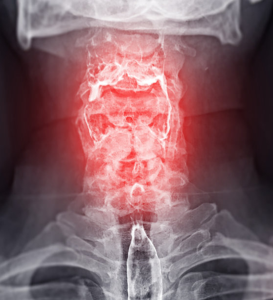 钡餐研究。图片下载