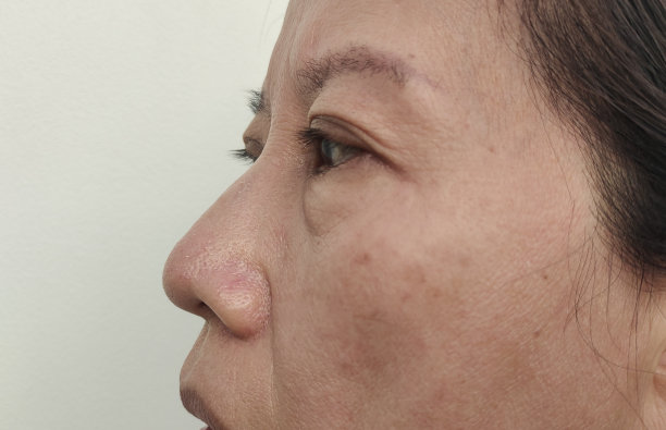脸上的瑕疵和雀斑，眼睑旁边的下垂，皱纹和暗沉。图片下载