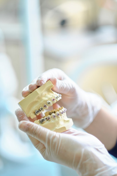 手拿着带托槽的义齿，特写。图片下载