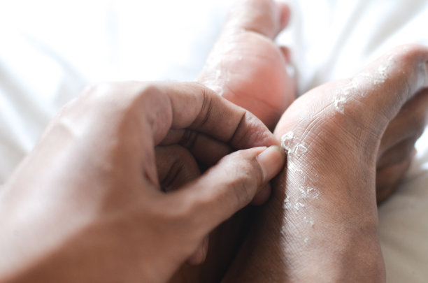 近距离观察从脚下剥落的皮肤图片下载