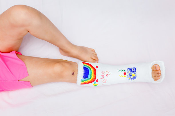 一个腿断了的面目全非的小女孩在家里的床上用毡头笔在矫形石膏上画画。如何在断了腿的情况下玩得开心。一个小孩的腿断了，打了石膏。图片下载