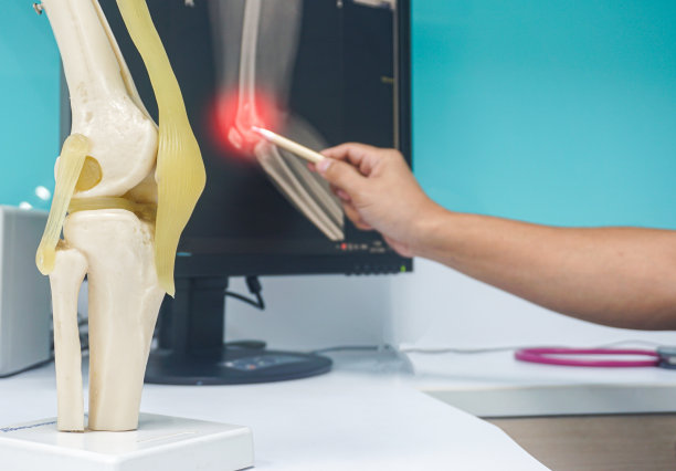 近距离模糊手医生点x光膝上显示器液晶和模型膝上的白色桌子。图片下载