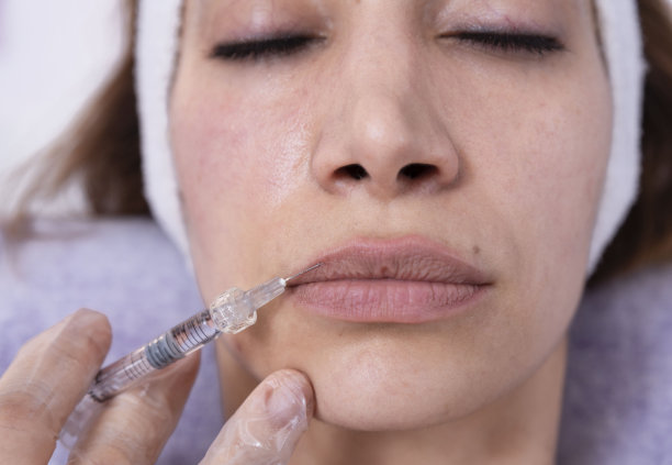 美容师为女性面部注射玻尿酸填充剂美容美发女性美容，丰唇手术图片下载