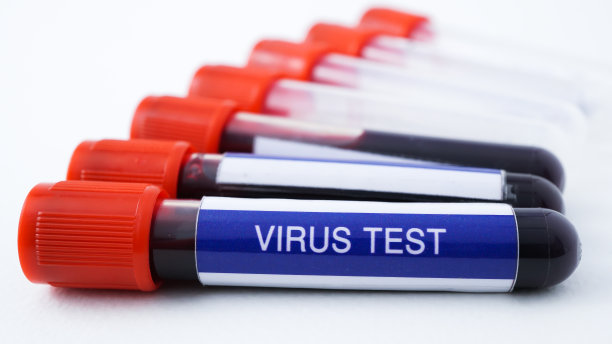 在白色背景上。用真血进行病毒检测的概念。图片下载