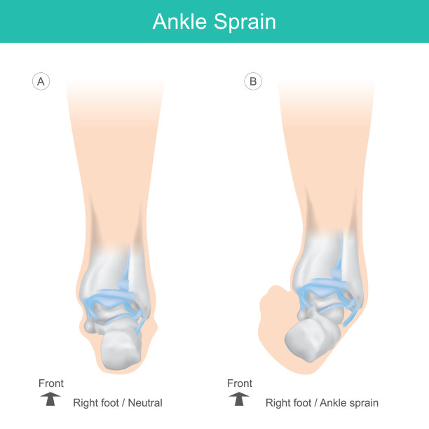 人类踝骨。正确的踝关节位置。说明卫生保健。图片下载