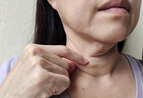 松弛的脂肪，下垂和皱纹脖子下松弛的皮肤。图片下载