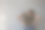 一名妇女肾脏有问题。图片下载