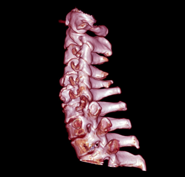 CT C-Spine或颈椎3D渲染图像图片下载