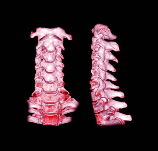 CT C-Spine或颈椎3D渲染图像图片下载