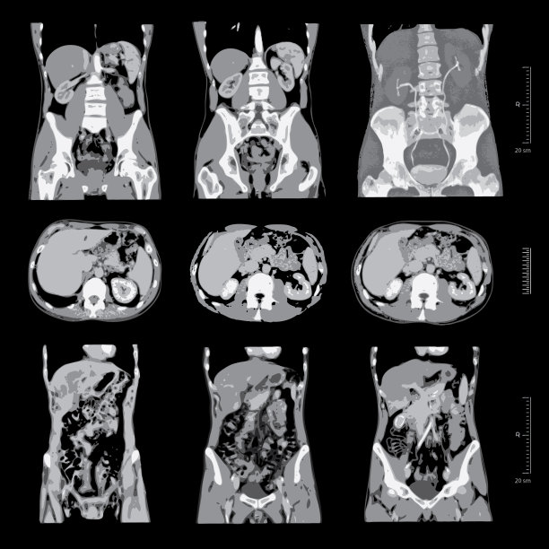适用于人体腹部及骨盆x线片图片下载