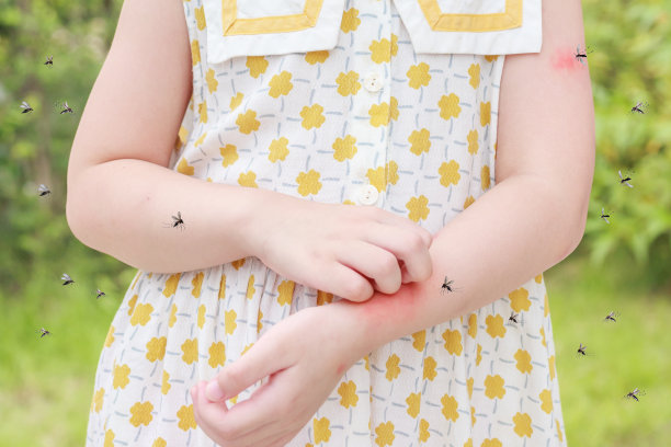 小女孩有皮疹，过敏，瘙痒和抓挠她的手臂被蚊子叮咬图片下载