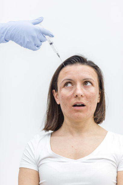 皮肤干燥的妇女的照片，手上戴着注射过的医用手套。图片下载