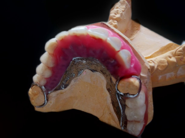 假体制造和未完成隔离在黑色背景。图片下载