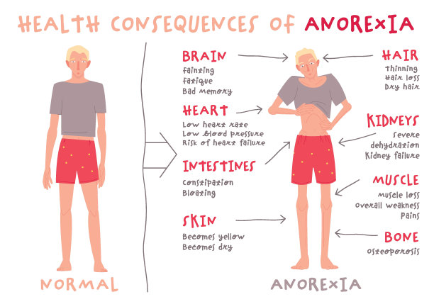 男性和男孩的饮食失调。神经性厌食。图片下载