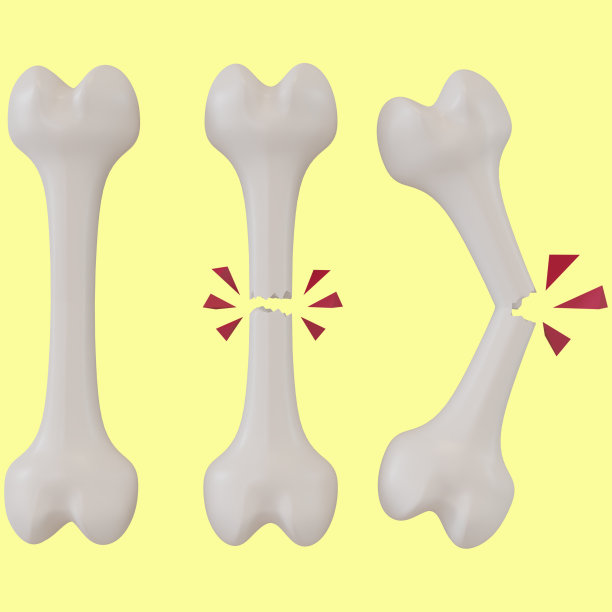 不同阶段骨折的3d渲染图图片下载