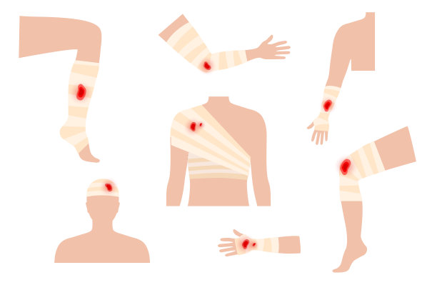 人类的四肢创伤图片下载