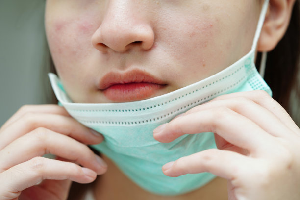 脸上的痘痘、疤痕、皮脂腺紊乱、少女护肤美容问题。图片下载