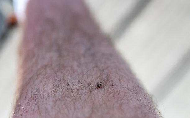 一只雄性狗蜱爬上一只高加索雄性狗蜱的腿毛。图片下载