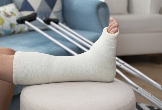 脚踝骨折，腿打了石膏图片下载