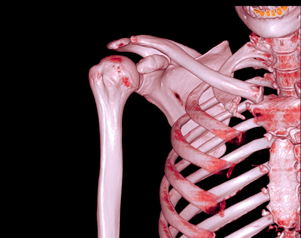 3 d CT的肩膀图片下载