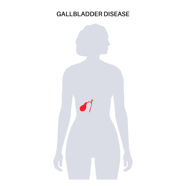 胆囊疾病的海报图片下载