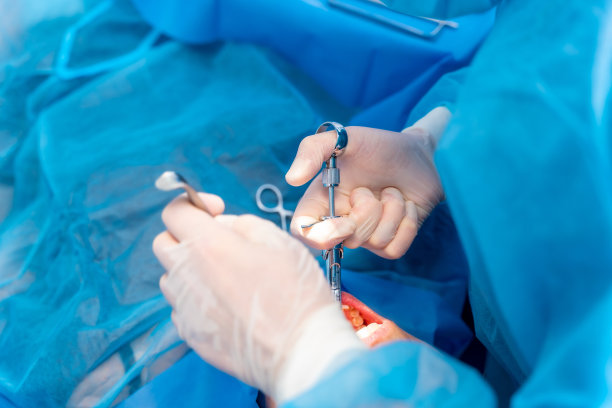 牙科门诊，女牙医医生在手术前进行麻醉注射图片下载