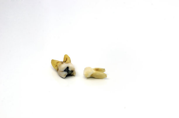 破碎的牙齿图片下载