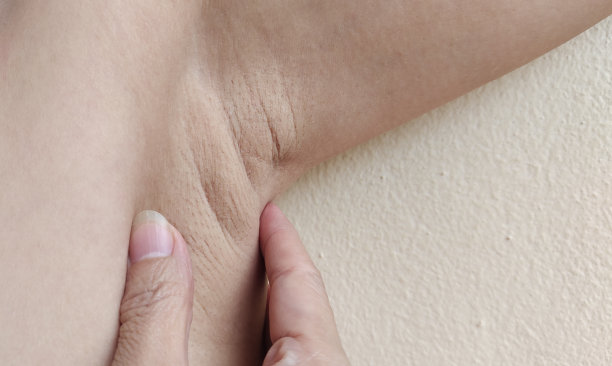 腋下的松弛脂肪下垂和皱纹，腋下的毛。图片下载