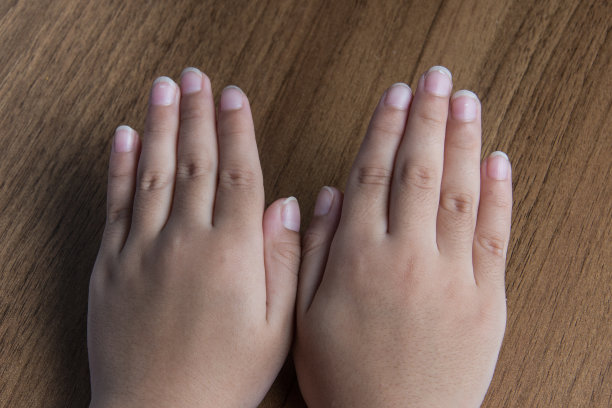 孩子们的指甲蓬乱、又长又脏图片下载